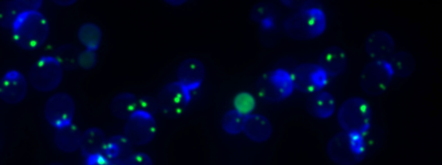 Peroxisomes labeled with GFP-SKL in budding yeast. Credit: Brooke Gardner
