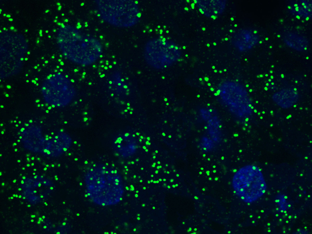 Fluorescence microscopy image of peroxisomes in HCT116s
